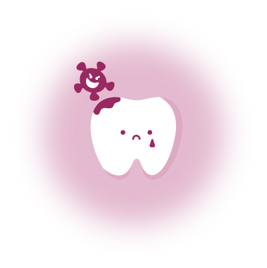 虫歯が起こる原因